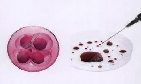 สื่อทางการแพทย์ ภาพขยายเซลล์เม็ดเลือดแดง
