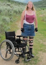 โคลเอ้ สาวใหญ่วัย 58 ปี ใส่เหล็กดามขายืนอยูข้างๆรถเข็นคนพิการ