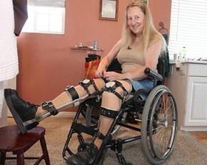 โคลเอ้ สาวใหญ่วัย 58 ปี ใส่เหล็กดามขาและนั่งอยูในรถเข็นคนพิการ
