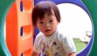 Down syndrome: Turning disability into positivity