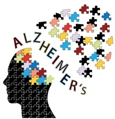 อัลไซเมอร์