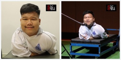พิการกาย ไม่พิการใจ “น้องไทด์” นักร้องพิการสู้ชีวิต