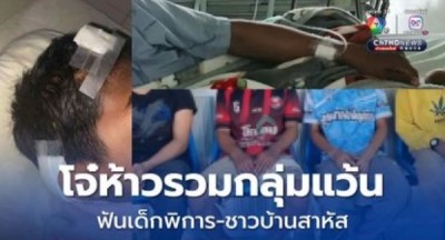 โจ๋ห้าวรวมกลุ่มแว้น เบิ้ลท่อเสียงดัง ฟันเด็กพิการ-ชาวบ้าน สาหัส 2