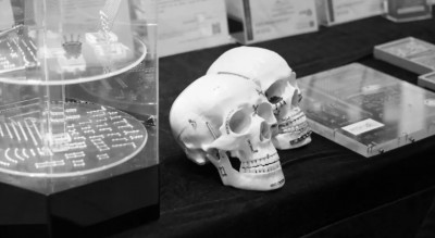 สมาคมความพิการปากแหว่ง เพดานโหว่ฯ ยกระดับการดูแลผู้ป่วยฯ ที่ จ.สงขลา