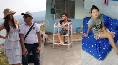 2 ผัวเมียเล่าวันที่เสียขาซ้าย เจ็บ ปวด สุดทรมาน จากความประมาทของคนอื่น