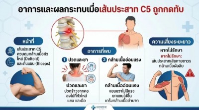 อุทาหรณ์ฟิตเนส เตือนสายยกเวท เสี่ยงหมอนรองกระดูก พิการถาวร