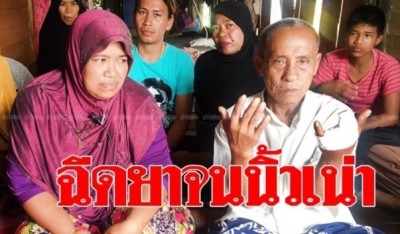 เฒ่าสตูลครวญ ถูกตัดนิ้วมือ กลายเป็นคนพิการ หลังหมอฉีดยาเข้าง่ามนิ้วจนเน่า