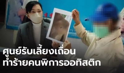 เร่งช่วยหนุ่มพิการออทิสติก หลังแม่ร้องสื่อ ถูกทำร้ายทารุณในศูนย์รับเลี้ยงเถื่อน
