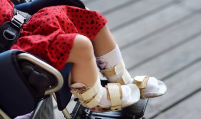 มหาวิทยาลัยเทคโนโลยีราชมงคลธัญบุรีอ้าแขนรับ เด็กพิการเข้าเรียน