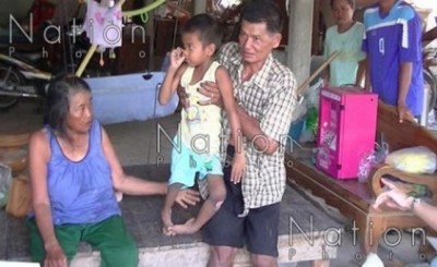 น้องเต้ วัย 6 ขวบ พิการขาจากอุบัติเหตุรถคว่ำ