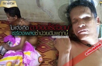 ลุงคาราบาว วัย 55 ปี พิการตาบอด
