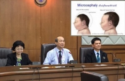 การประชุมคณะกรรมการพิจารณาแนวทางเวชปฏิบัติการวินิจฉัยและดูแลหญิงตั้งครรภ์ที่สงสัยติดเชื้อไวรัสซิกา ร่วมกับราชวิทยาลัยสูตินรีแพทย์แห่งประเทศไทย ผู้แทนสูตินรีแพทย์จากคณะแพทยศาสตร์รามาธิบดี ศิริราช ราชวิถี ฯลฯ