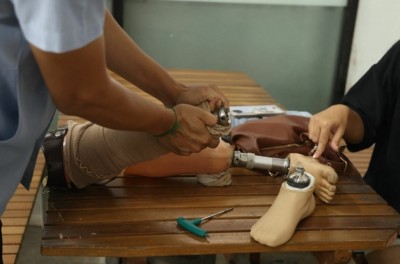 “เท้าเทียมไดนามิก” นวัตกรรมไทยในระบบบัตรทอง