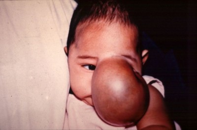 อาจารย์ ‘จรัญ’ แพทย์รางวัลสมเด็จพระวันรัต ผู้บันดาลใจ-มอบชีวิตใหม่ให้ผู้พิการใบหน้า