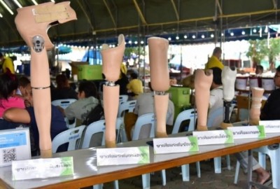"องคมนตรี" เป็นประธานเปิดการทำขาเทียมพระราชทาน แก่ผู้พิการขาขาด
