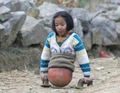 “เฉียน หงเยี่ยน - เด็กหญิงลูกบาส”นักว่ายน้ำคนพิการจีนคว้าเหรียญรางวัลอีก
