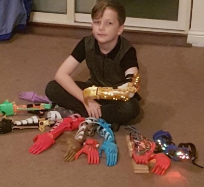 คุณพ่อผันตัวเป็นนักประดิษฐ์ สร้างแขนกลไบโอนิคเพื่อลูกชายพิการ เพิ่มโอกาสแก่ลูก