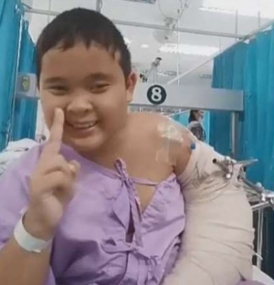 สัญญาณดี ‘น้องแมนยู’ แขนซ้ายที่ขาด เริ่มรับความรู้สึกได้แล้ว