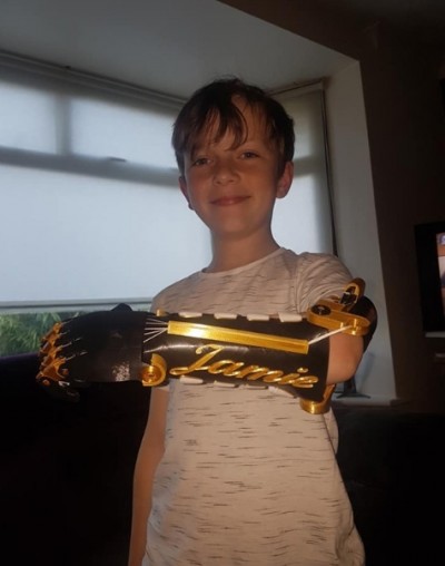 คุณพ่อผันตัวเป็นนักประดิษฐ์ สร้างแขนกลไบโอนิคเพื่อลูกชายพิการ เพิ่มโอกาสแก่ลูก