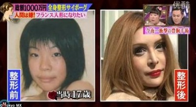 สาวญี่ปุ่นก่อนทำปละหลังทำศัลยกรรม 30 ครั้งเพื่อให้เหมือน ตุ๊กตาฝรั่งเศส