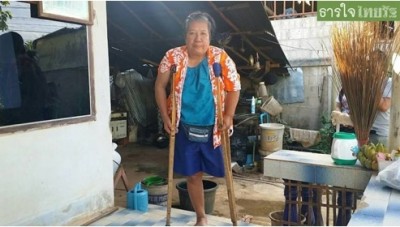 นางรัชนู สุประการ อายุ 57 ปี พิการขาขาด 1 ข้าง