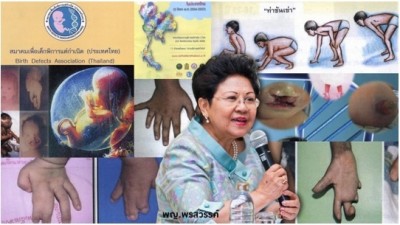 ศาสตราจารย์เกียรติคุณ แพทย์หญิง พรสวรรค์ วสันต์ นายกสมาคมเพื่อเด็กพิการแต่กำเนิด (ประเทศไทย)