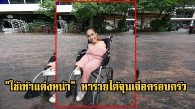พิการแค่ตัว แต่หัวใจเกินร้อย น้องฝ้าย สาวน้อยสู้ชีวิต