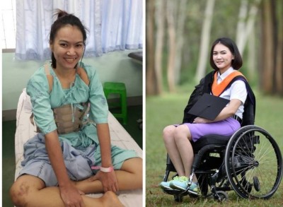 ชีวิตรันทด สาววัย 23 ถูกรถชนจนพิการ แฟนหนุ่มทิ้ง กัดฟันสู้ชีวิตจนถึงฝัน