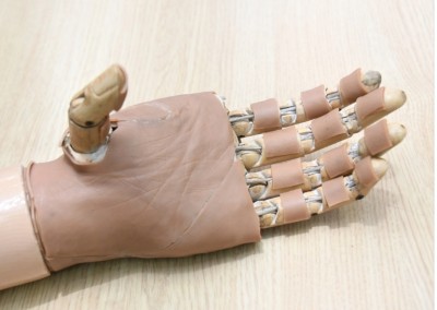 อาชีวะ-มูลนิธิสายใจไทย ร่วมผลิตมือกลเพื่อผู้พิการทางมือ