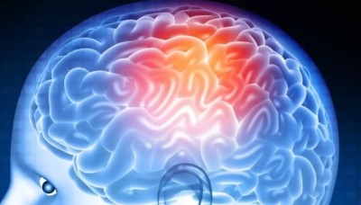 เลือดออกในสมอง : เลือดออกใต้เยื่อหุ้มสมองชั้นกลาง อันตรายที่อาจมาถึงอย่างฉับพลัน