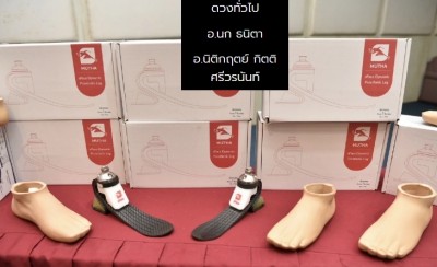 ฝีมือคนไทย! พัฒนาเท้าเทียมไดนามิก sPace เพื่อผู้พิการ
